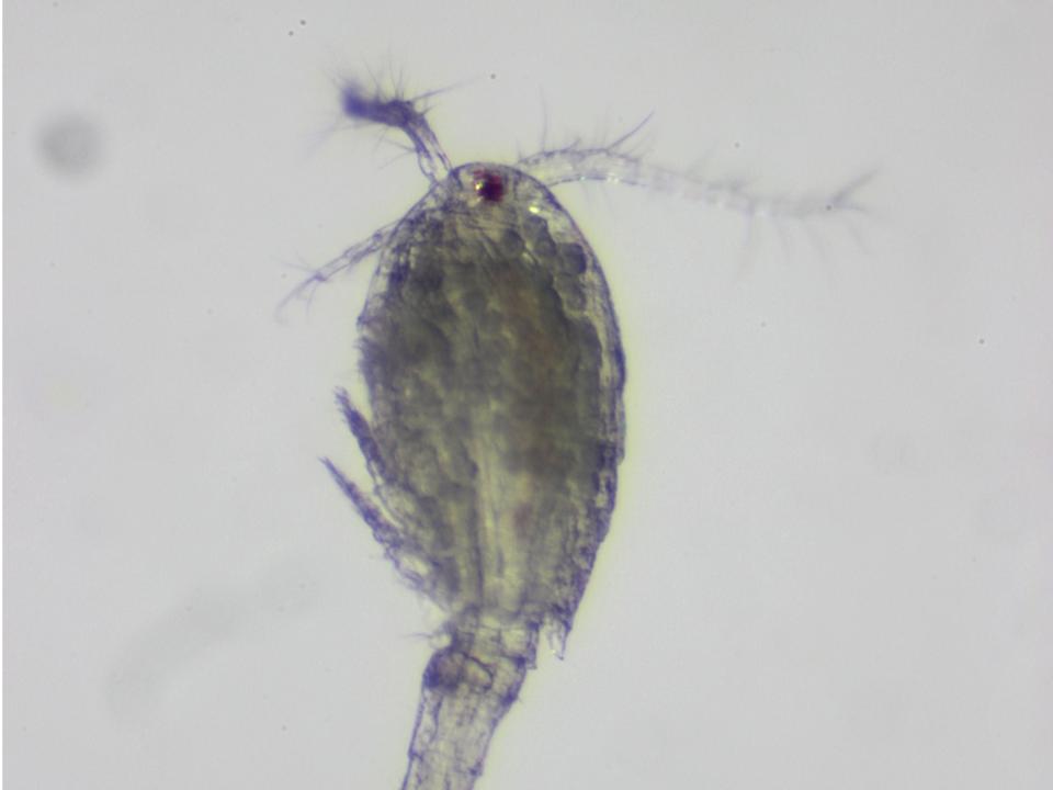 They are Acanthocyclops robustus, and were isolated from ponds at Pickering Creek Audubon Center in Easton, MD. Photo by Catherine Fitzgerald 