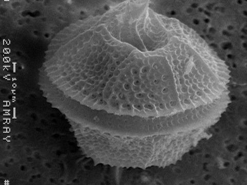 dinoflagellate
