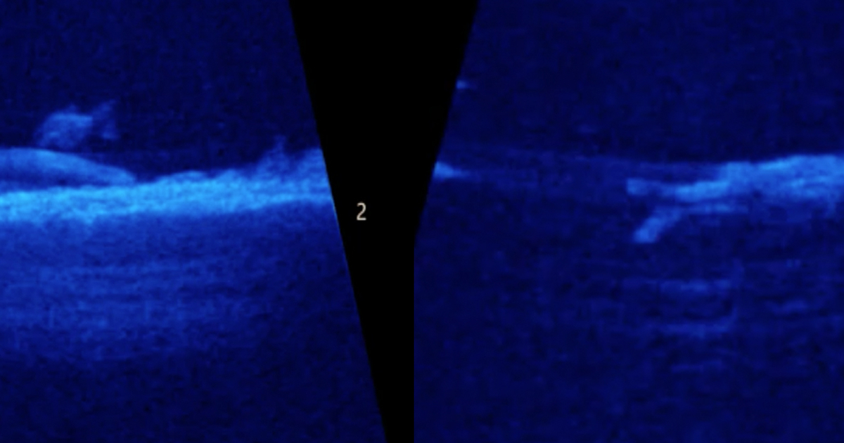 Using sound, scientists search murky Bay waters University of