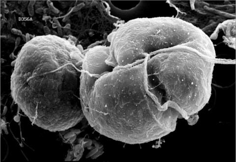 A scanning electron micrograph of Karlodinium veneficum cell attached to a prey cryptophyte in the process of ingestion.