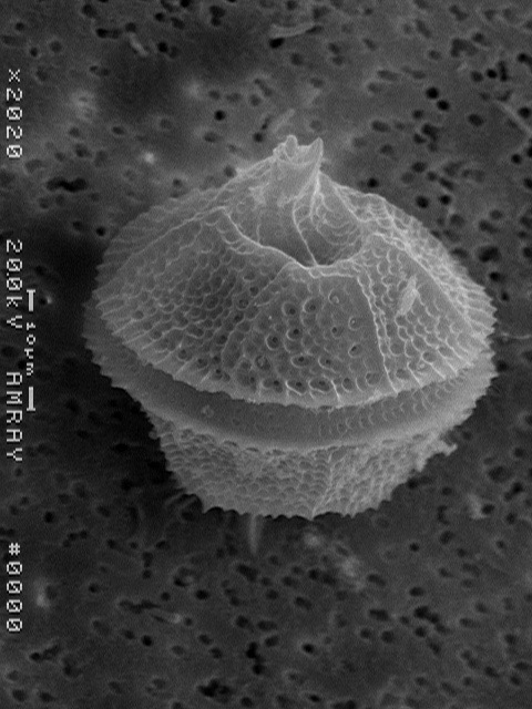 UMCES molecular geneticist helps map evolution of dinoflagellates
