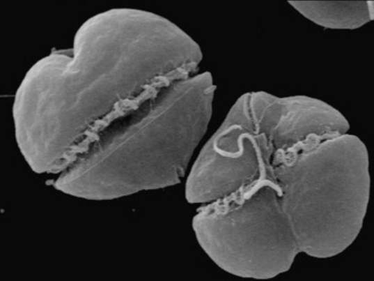 UMCES Researchers Find Connection Between Hurricanes and Harmful Algal Blooms