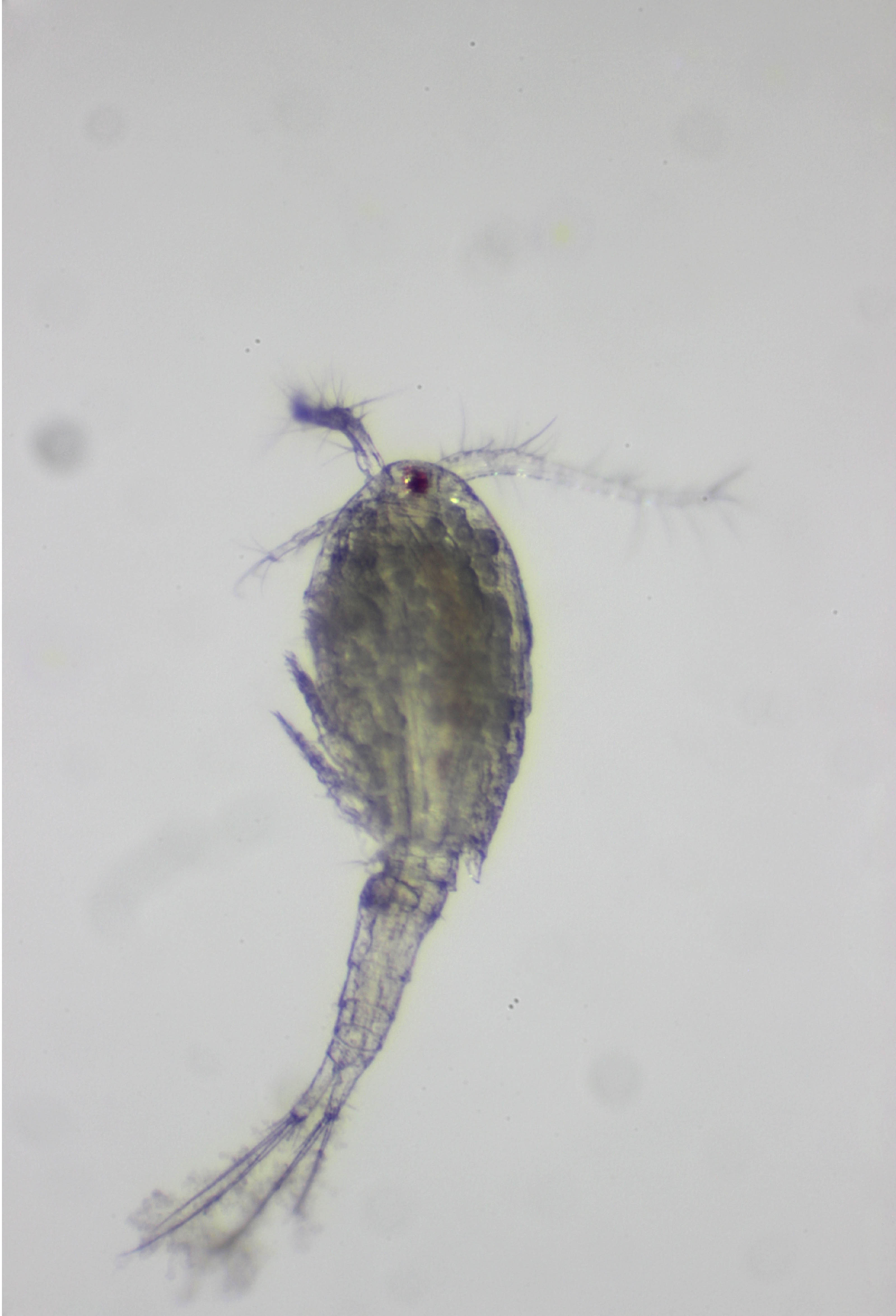 They are Acanthocyclops robustus, and were isolated from ponds at Pickering Creek Audubon Center in Easton, MD. Photo by Catherine Fitzgerald