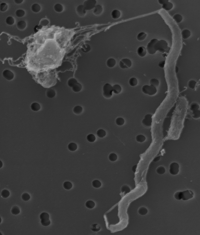 Black Sea Microbes Microbes