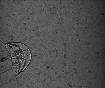 Anything that disrupts the parallel light path creates a “shadow" that is photographed by the system